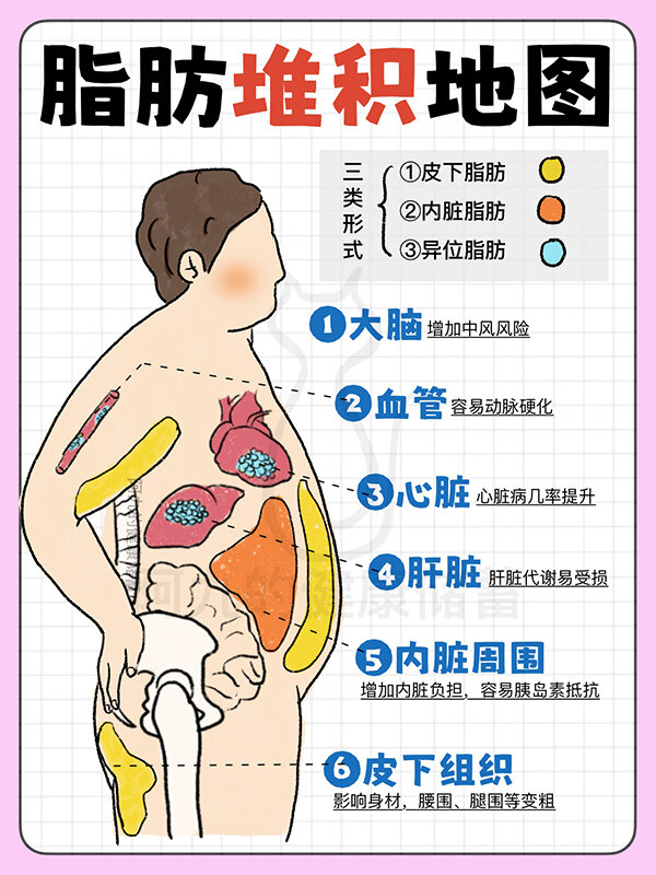 相识脂肪堆积地图